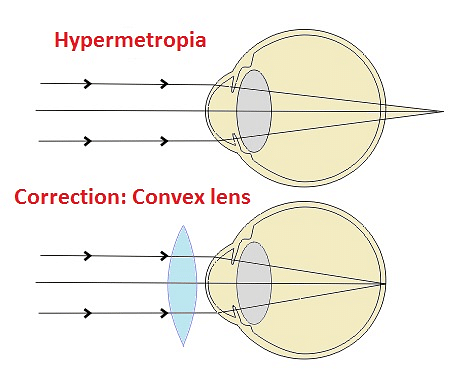 uses of concave lens in daily life