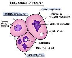 Viral Inclusion Bodies - an overview