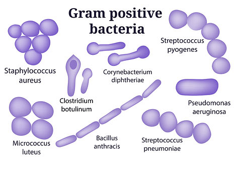 gram positive bacilli