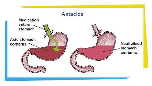 Neutralization In Everyday Life Definition Importance Antacids Treatment