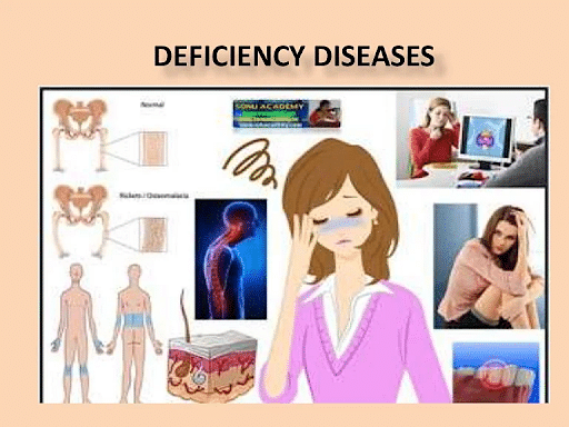 vitamin e deficiency diseases name