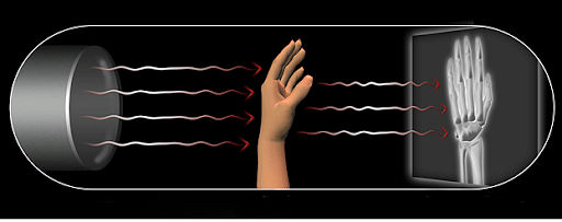 x ray waves uses