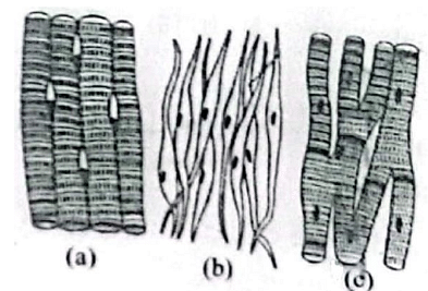 Three types of muscles are given as a, b and c