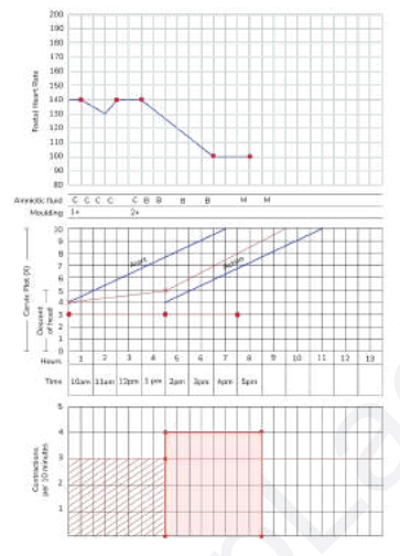  partogram of a woman