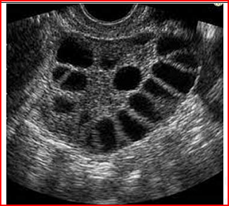 the ultrasound for abdominal pain