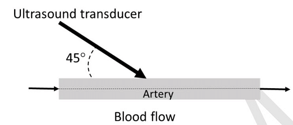 Ultrasound Transducer